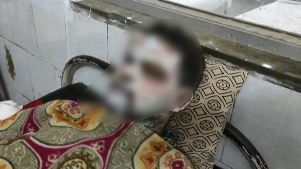 acid attack in train acid attack in train